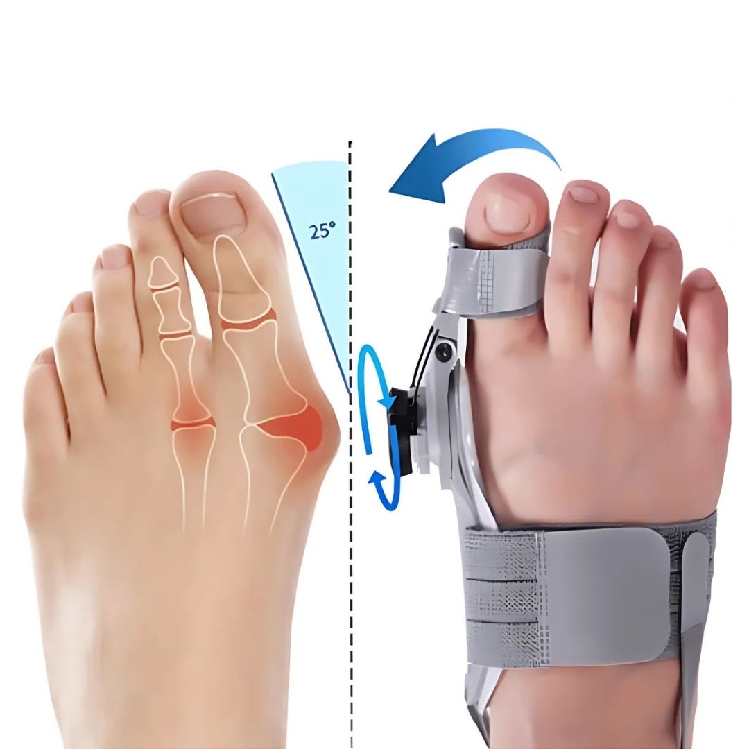 Adjustable Bunion Support with Toe Separator for Hallux Valgus