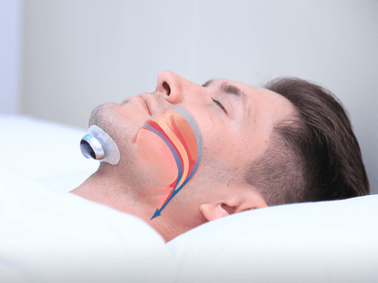 Anti-Snoring Device with Adjustable Pulse Settings