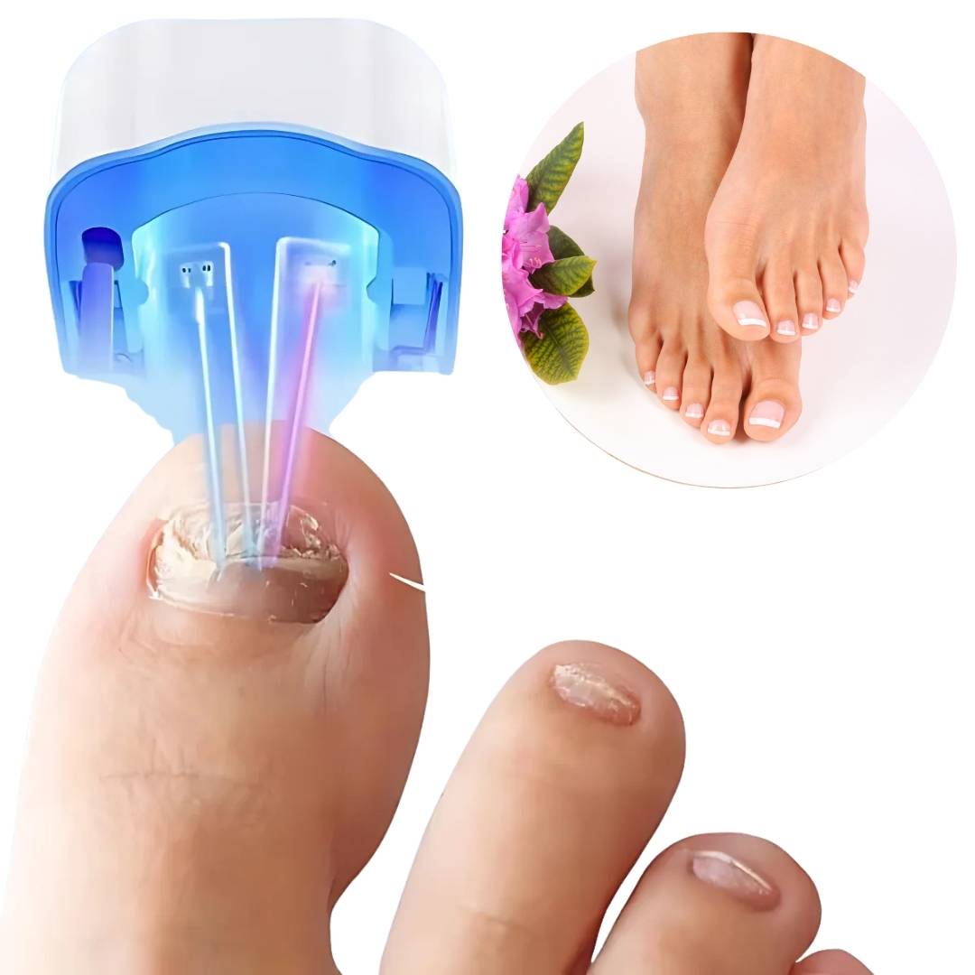 Nail Fungus Laser Device for At-Home Nail Care