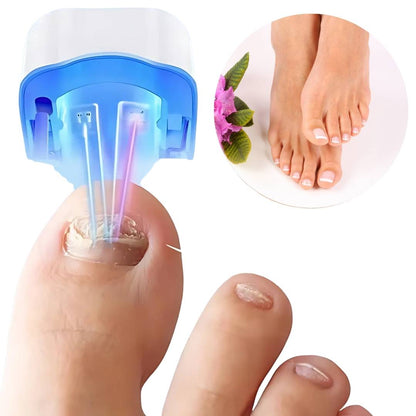 Nail Fungus Laser Device for At-Home Nail Care