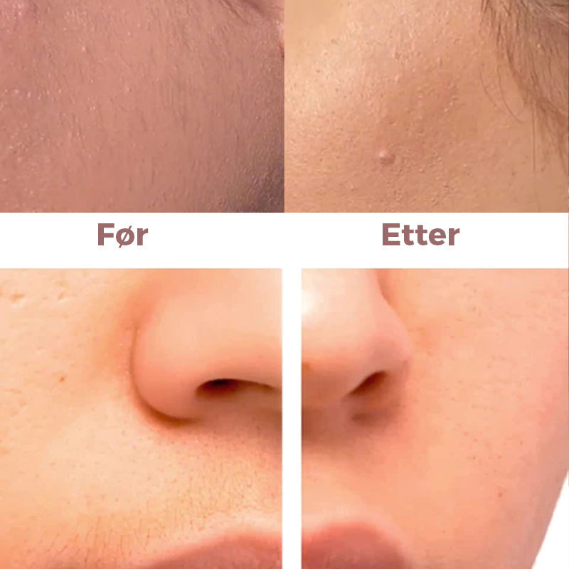 Rechargeable Facial Hair Remover with Compact USB Design