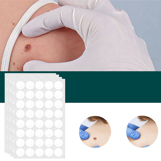 Skin Patches for Skin Tags and Warts